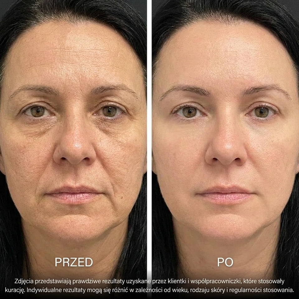 Przed i po — klientka Bioceutica