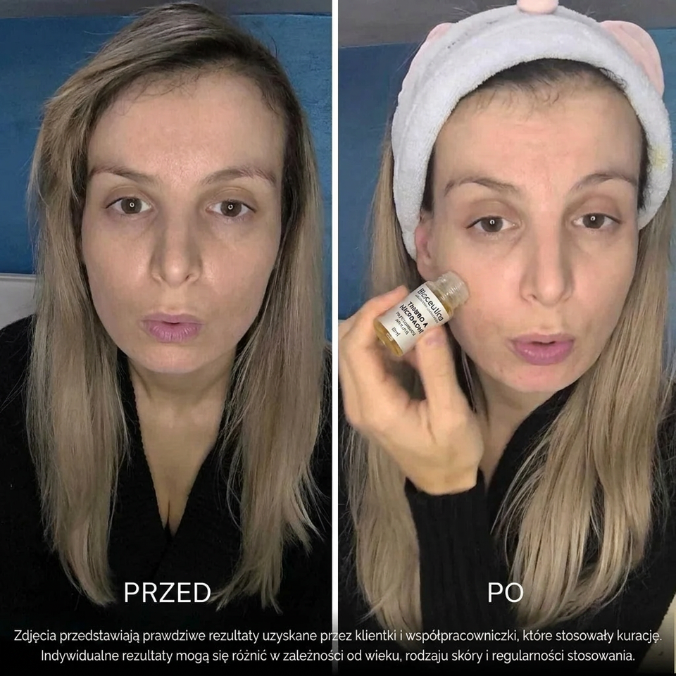 Przed i po — klientka Bioceutica